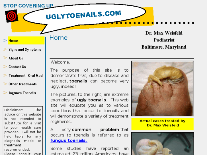 www.uglytoenails.com