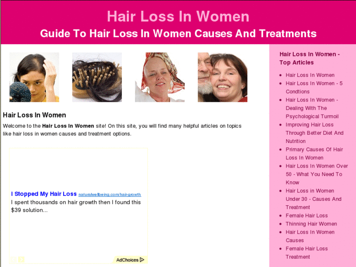 www.hairloss-in-women.com