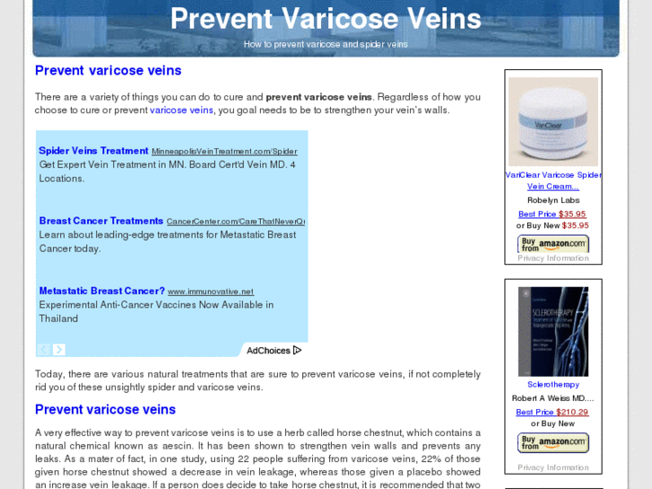 www.preventvaricoseveins.net