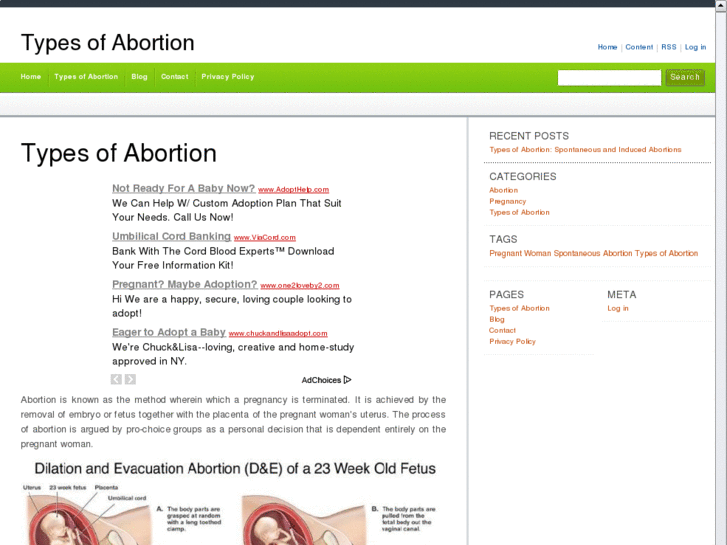 www.typesofabortion.net