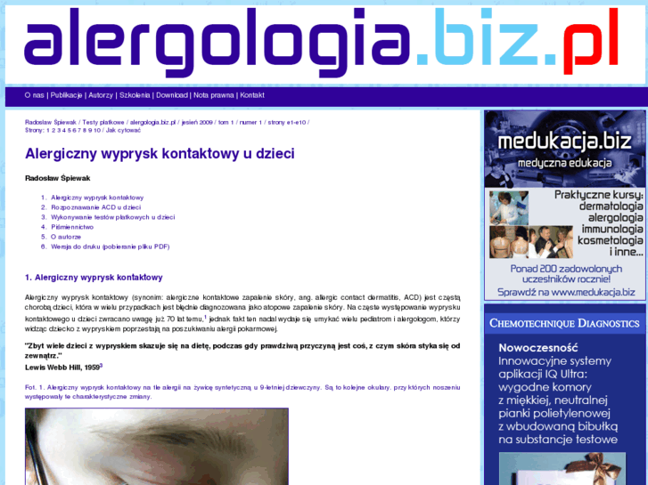 www.alergologia.biz.pl