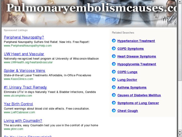 www.pulmonaryembolismcauses.com