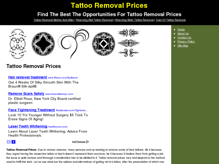 www.tattooremovalprices.net