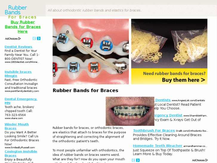 www.rubberbandsforbraces.com