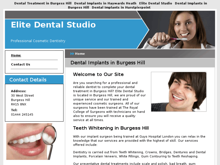 www.dentalimplantsburgesshill.com