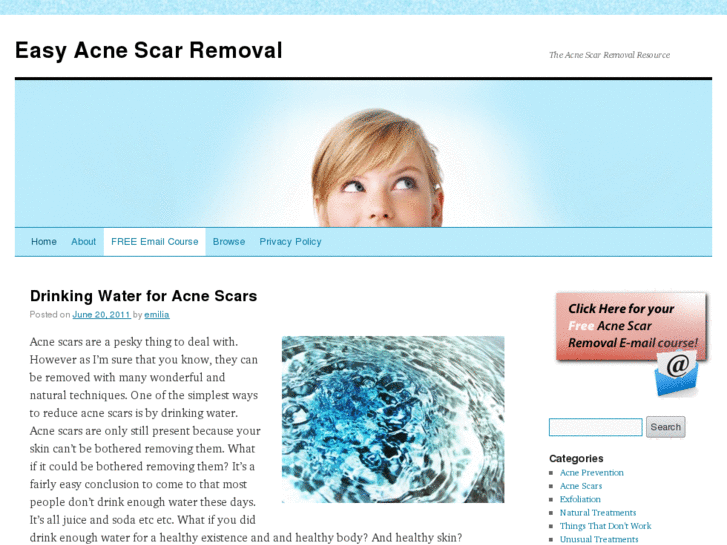 www.easyacnescarremoval.com