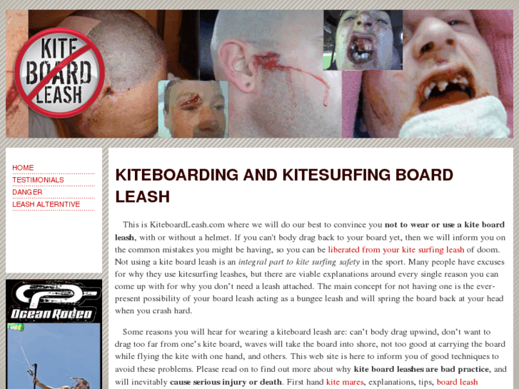 www.kiteboardleash.com