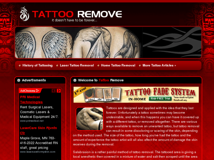 www.tattoo-remove.com