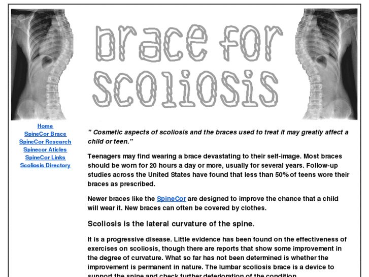 www.braceforscoliosis.com