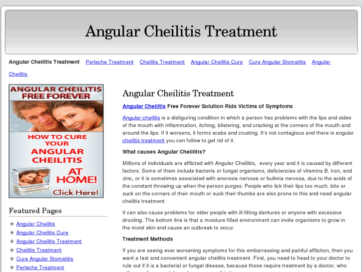 www.angularcheilitis-treatment.com