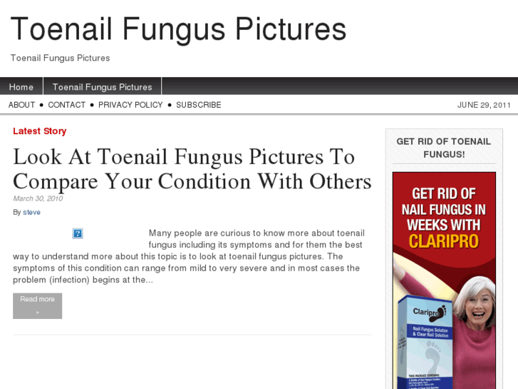 www.toenailfunguspictures.org