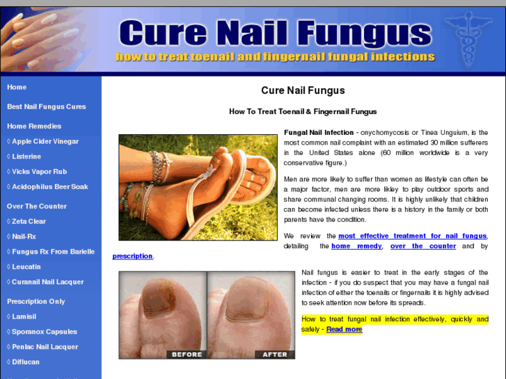 www.cure-nailfungus.com