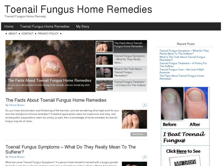 www.toenailfungushomeremedies101.com