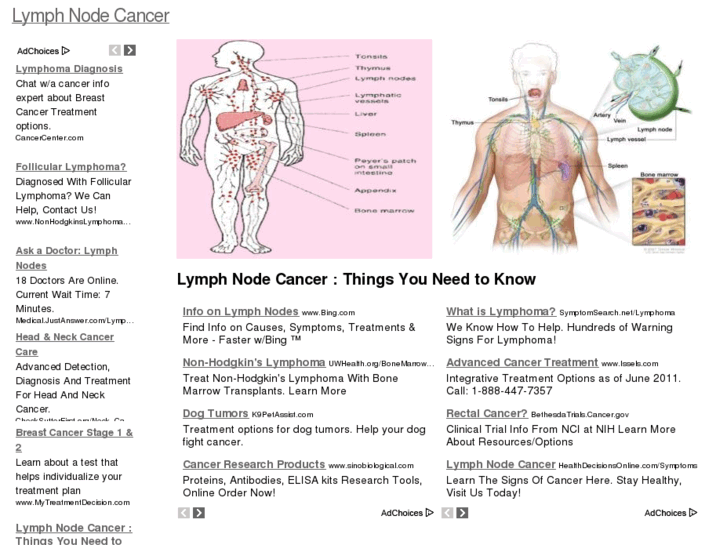 www.lymphnodecancerblog.com