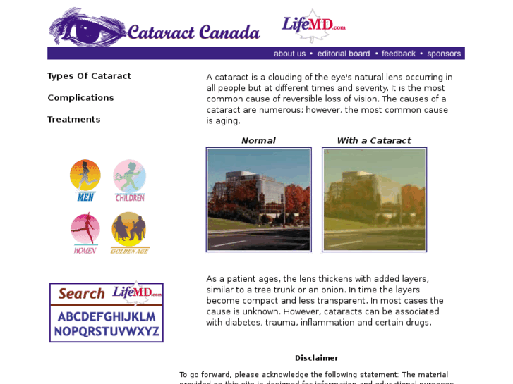 www.cataractcanada.com