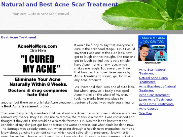 www.acnescarnaturaltreatment.org