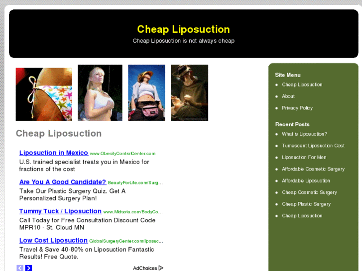 www.cheapliposuction.org