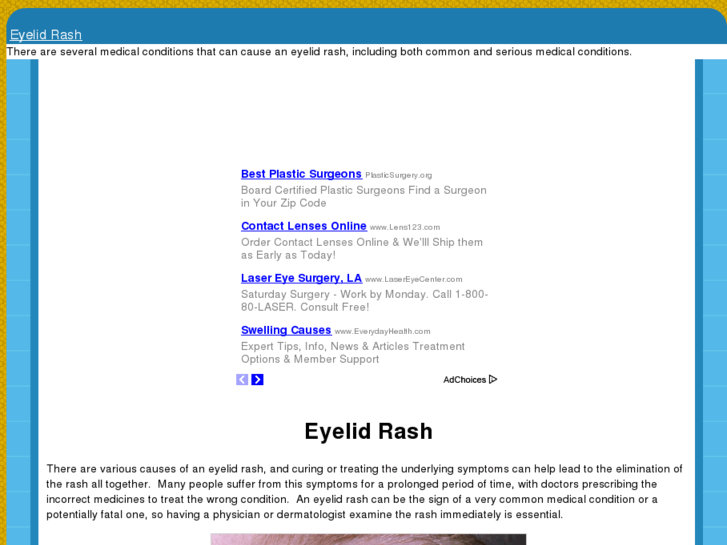 www.eyelidrash.com