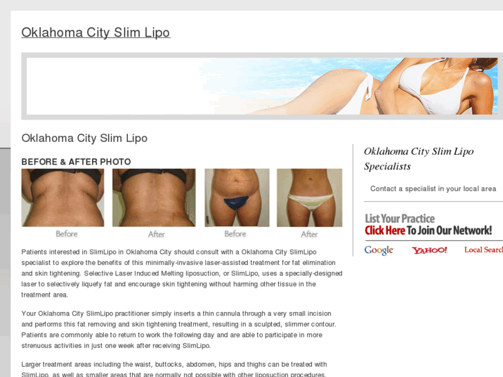 www.oklahomacityslimlipo.com