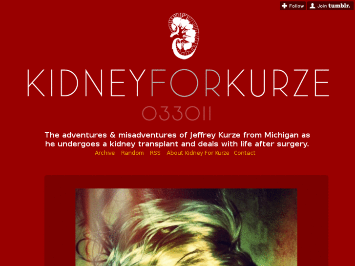 www.kidneyforkurze.com