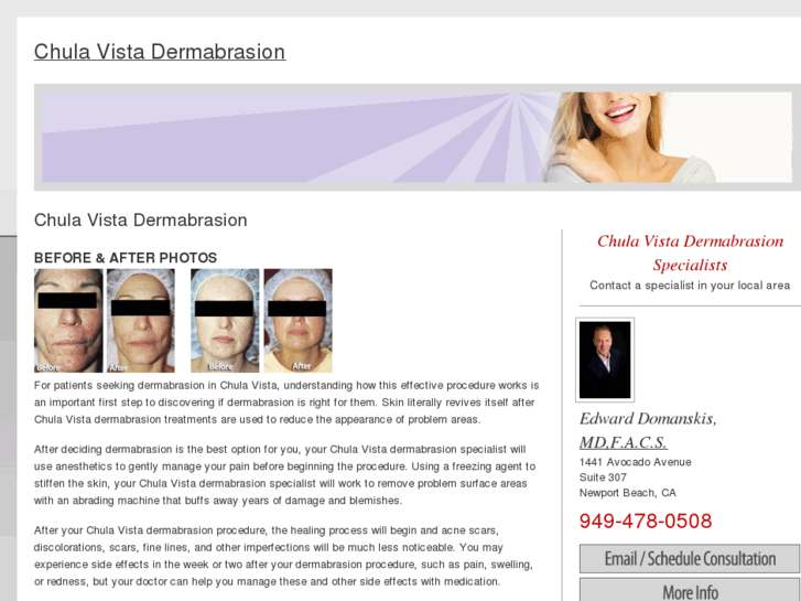 www.chulavistadermabrasion.com