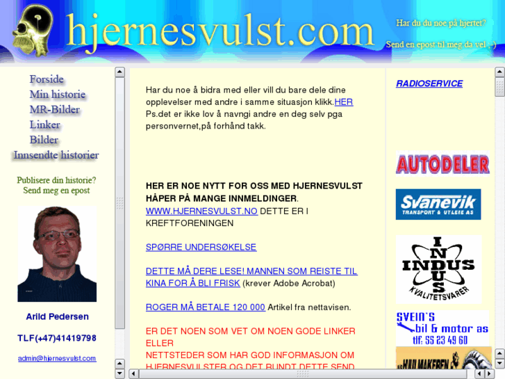 www.hjernesvulst.com