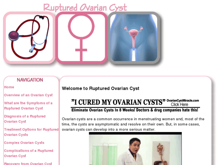 www.rupturedovariancyst.com