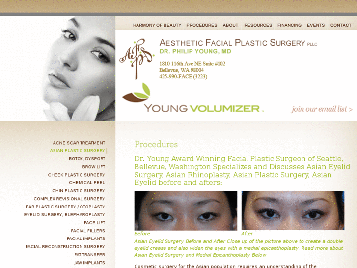 www.asianeyeplasticsurgery.com