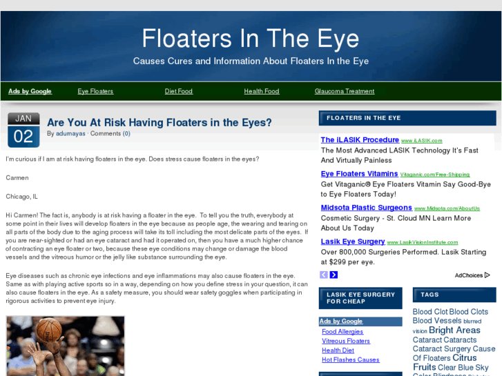 www.floatersintheeye.com