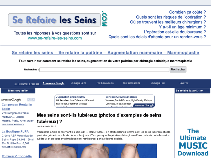 www.se-refaire-les-seins.com