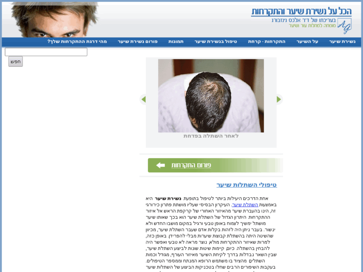 www.hairloss.co.il