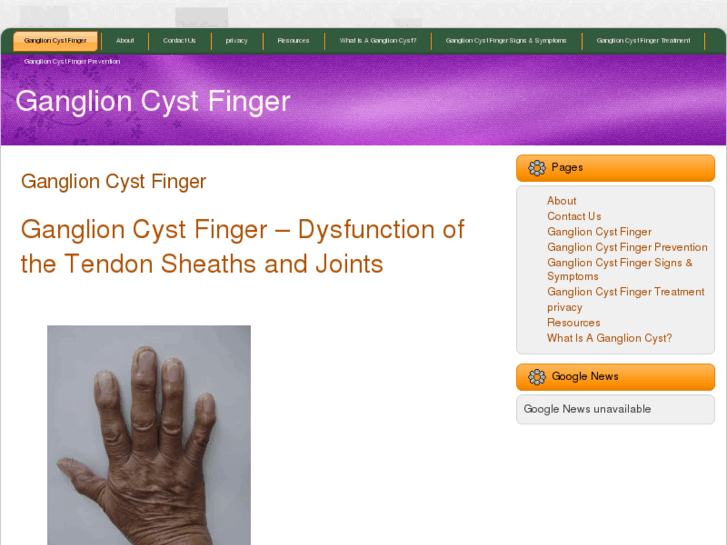www.ganglioncystfinger.com