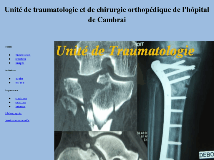 www.traumatologie-chcambrai.com