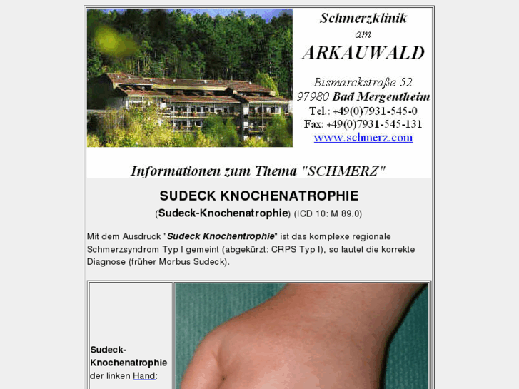 www.sudeck-knochenatrophie.de