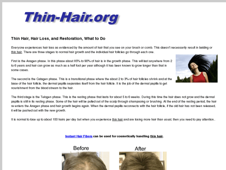 www.thin-hair.org