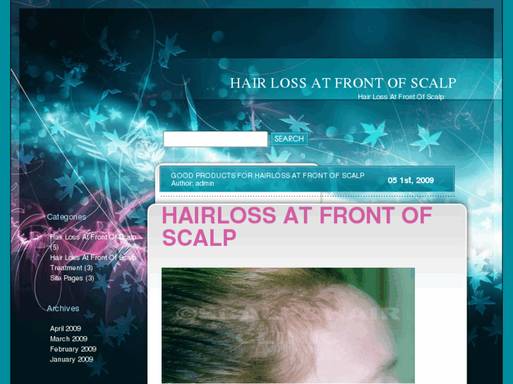 www.hairlossatfrontofscalp.com