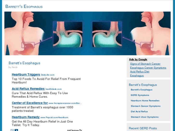 www.barretts-esophagus.net