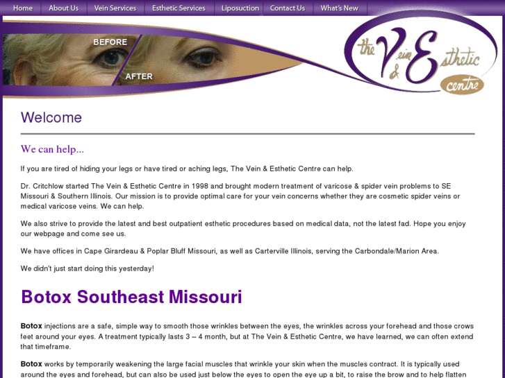 www.botox-southeast-missouri.com