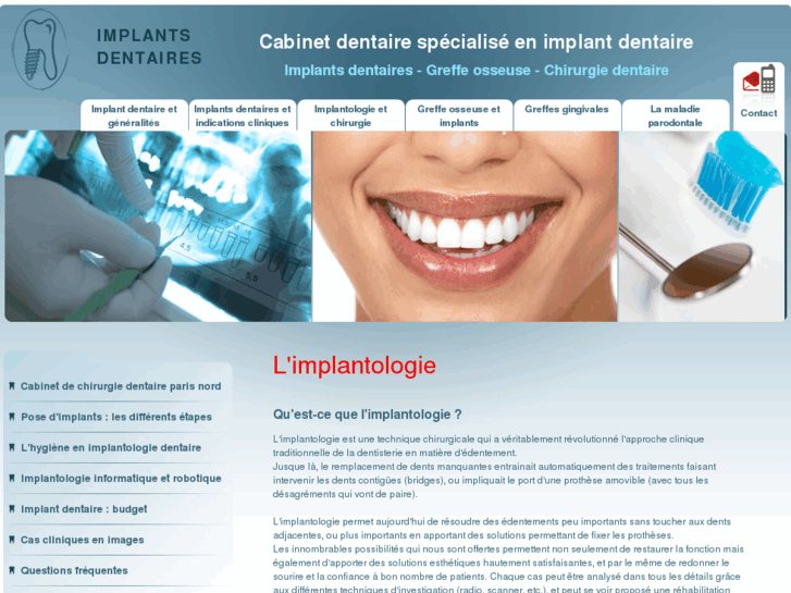 www.implants-dents.com