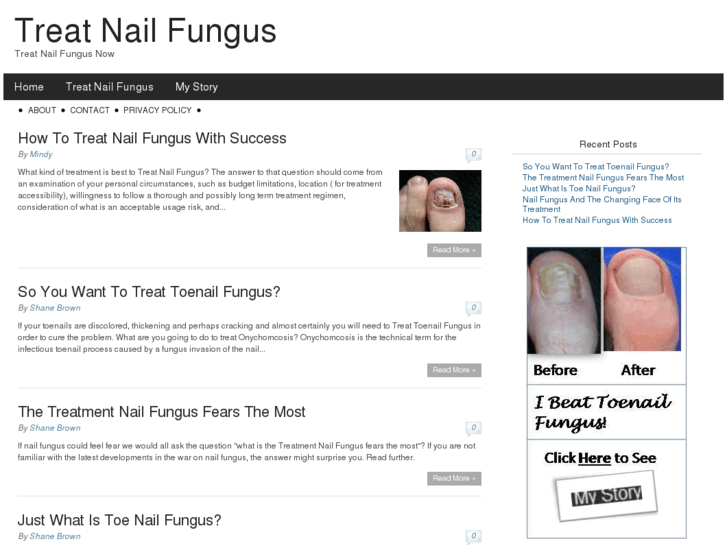 www.treatnailfungus101.org