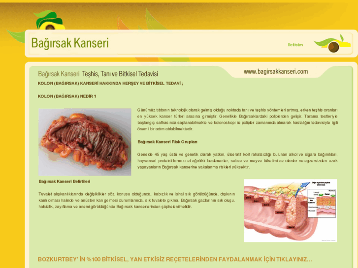 www.bagirsakkanseri.com