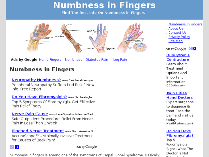 www.numbnessinfingers.net