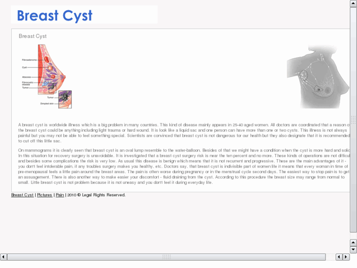 www.breastcyst.net