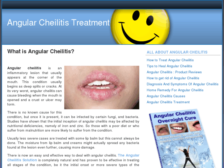 www.angularcheilitistreatment.net
