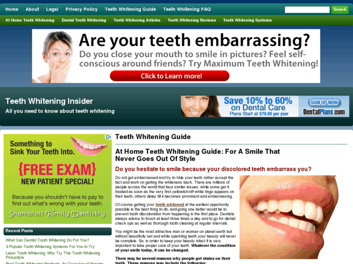 www.teethwhiteninginsider.com