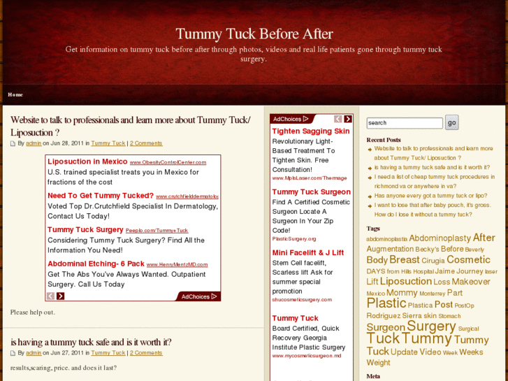 www.tummytuckbeforeafter.net