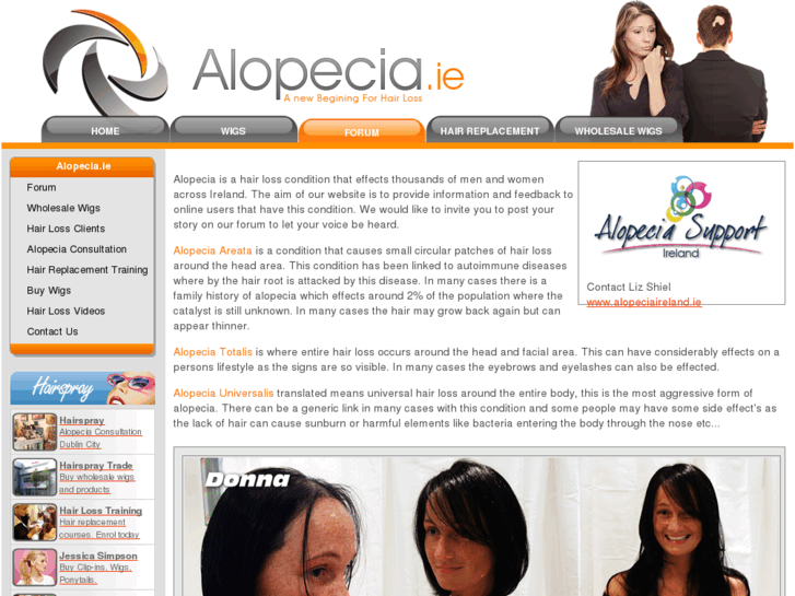 www.alopecia.ie