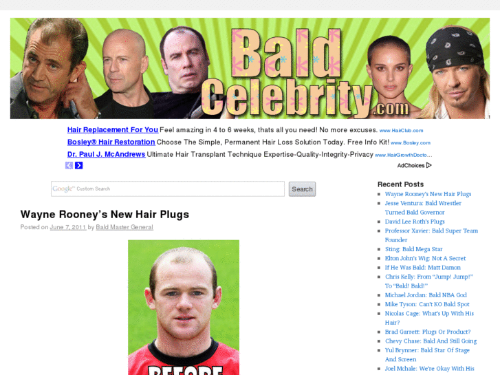 www.baldcelebrity.com