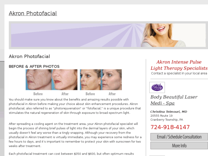 www.akronphotofacial.com