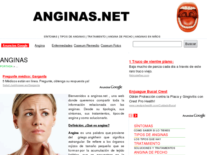 www.anginas.net